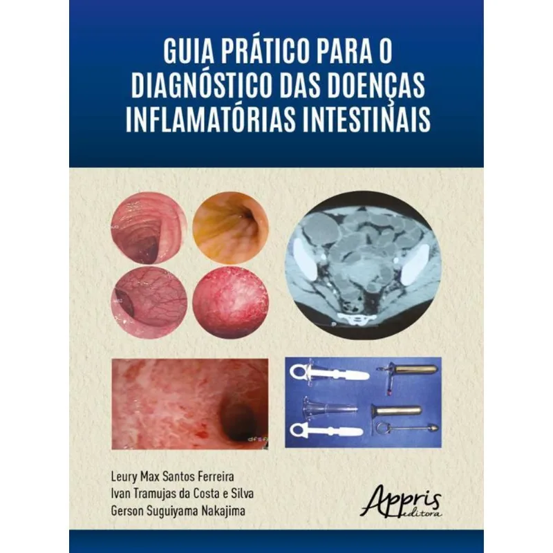 GUIA PRÁTICO PARA O DIAGNÓSTICO DAS DOENÇAS INFLAMATÓRIAS INTESTINAIS