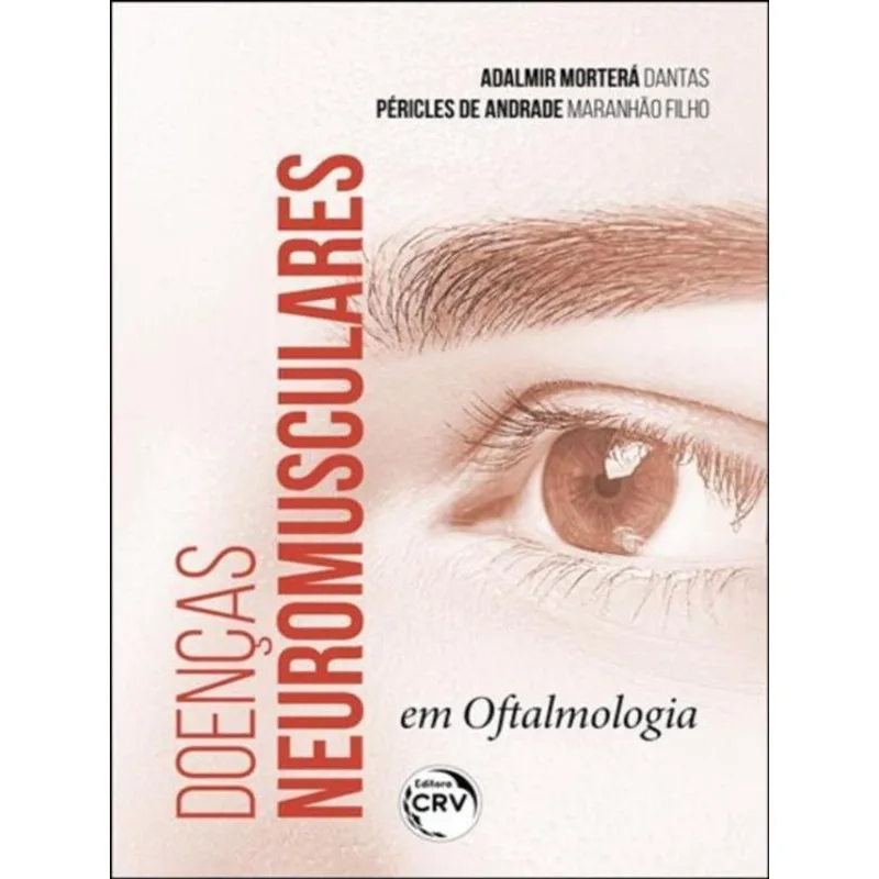 DOENÇAS NEUROMUSCULARES EM OFTALMOLOGIA