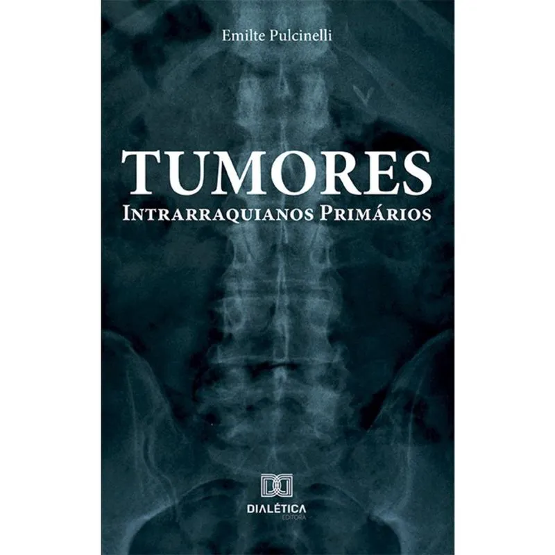 Tumores Intrarraquianos Primários