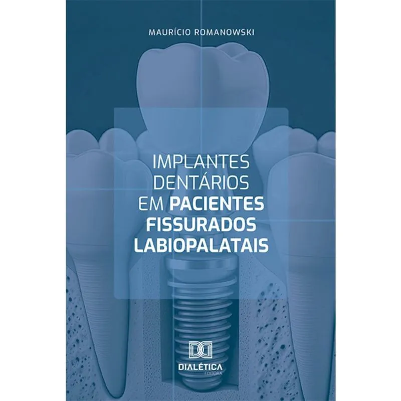 Implantes dentários em pacientes fissurados labiopalatais