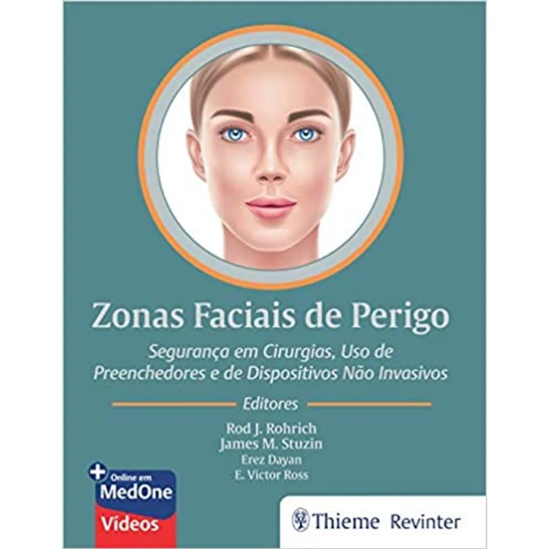 ZONAS FACIAIS DE PERIGO