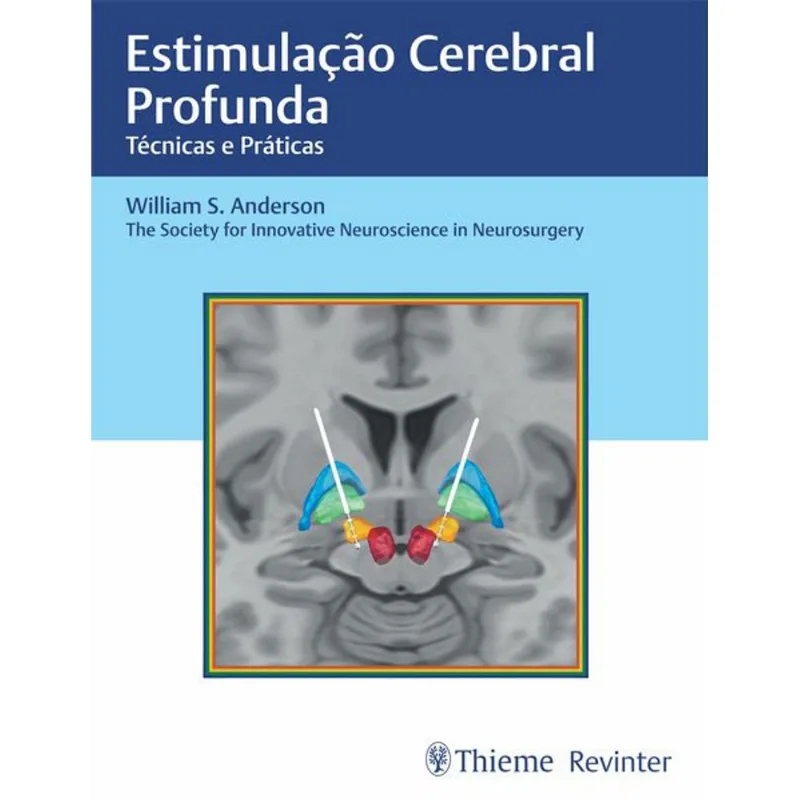 ESTIMULAÇÃO CEREBRAL PROFUNDA