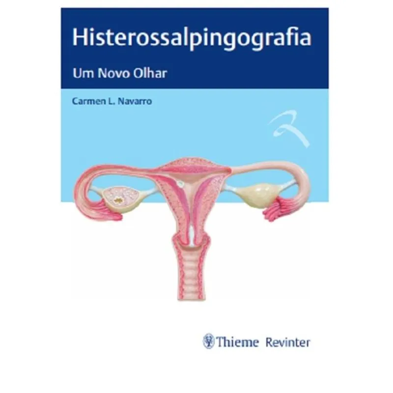 Histerossalpingografia