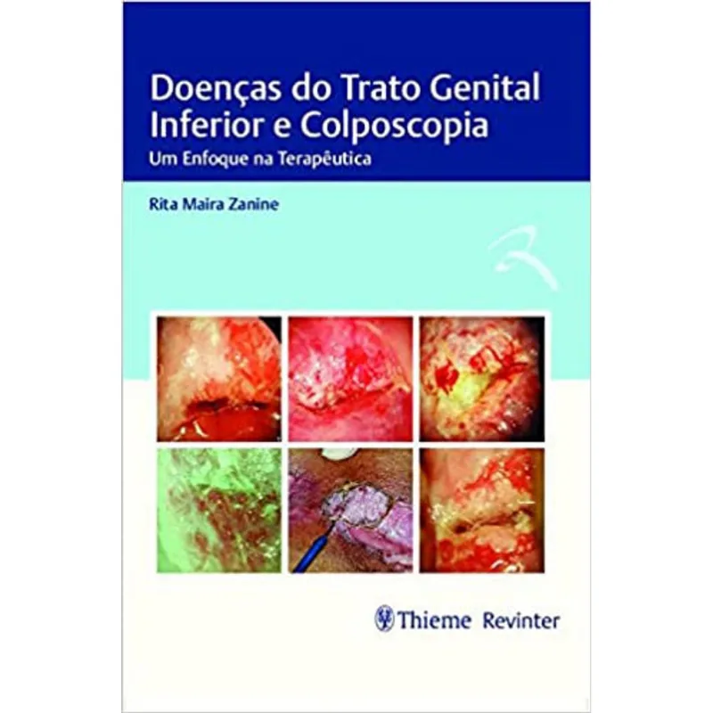 DOENÇAS DO TRATO GENITAL INFERIOR E COLPOSCOPIA