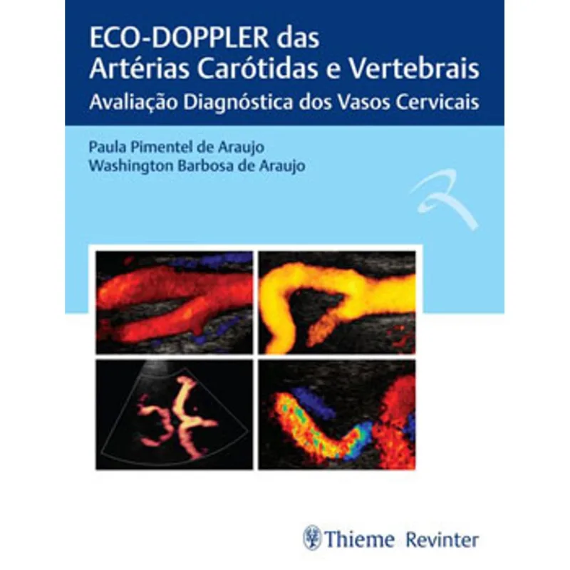 ECO-DOPPLER DAS ARTÉRIAS CARÓTIDAS E VERTEBRAIS