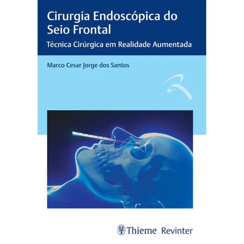 CIRURGIA ENDOSCÓPICA DO SEIO FRONTAL