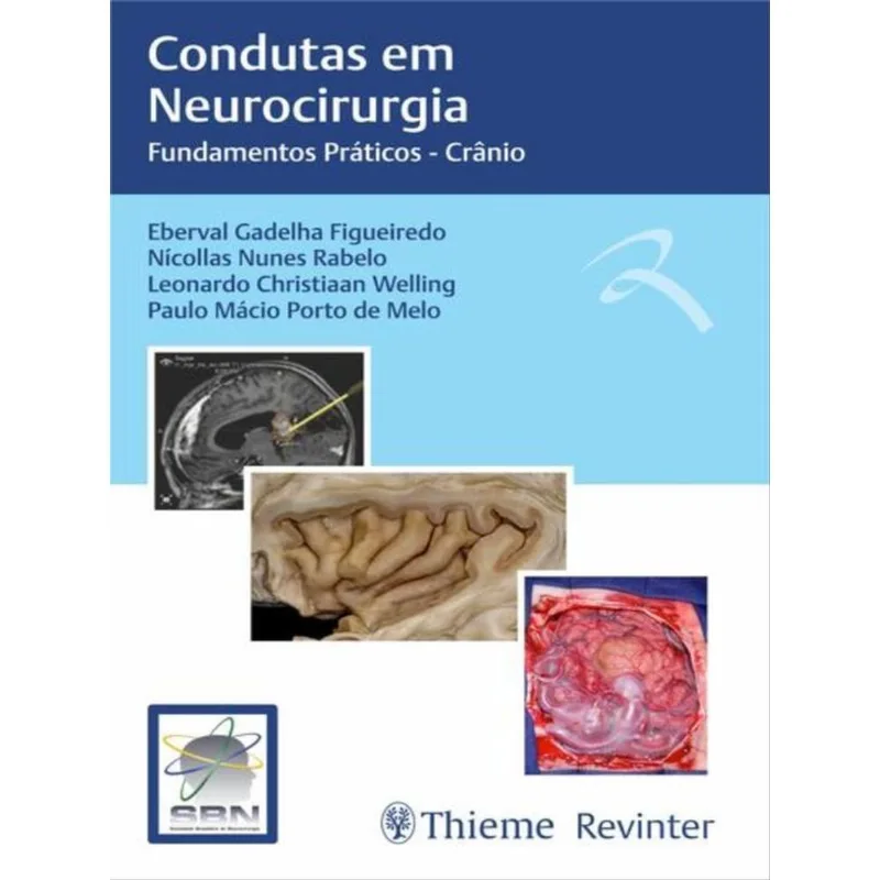 SBN CONDUTAS EM NEUROCIRURGIA