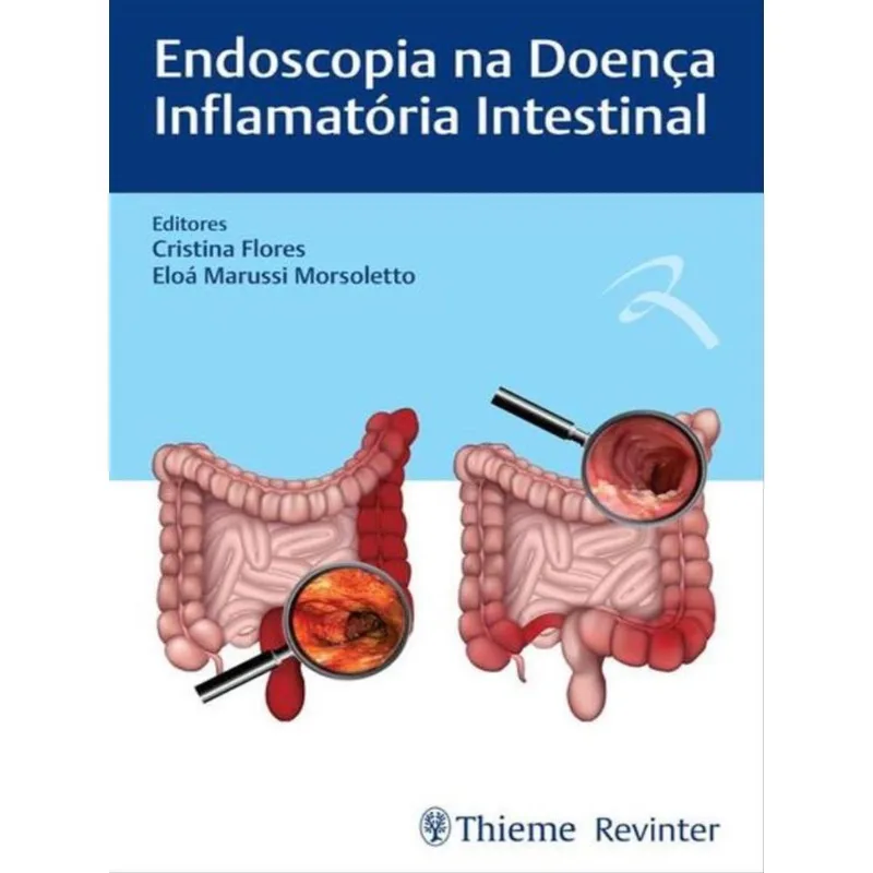 ENDOSCOPIA NA DOENÇA INFLAMATÓRIA INTESTINAL