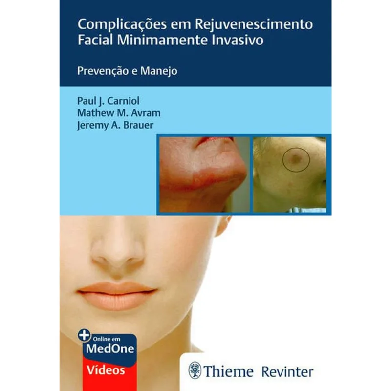 COMPLICAÇÕES EM REJUVENESCIMENTO FACIAL MINIMAMENTE INVASIVO