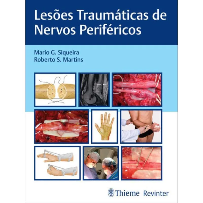 LESÕES TRAUMÁTICAS DE NERVOS PERIFÉRICOS