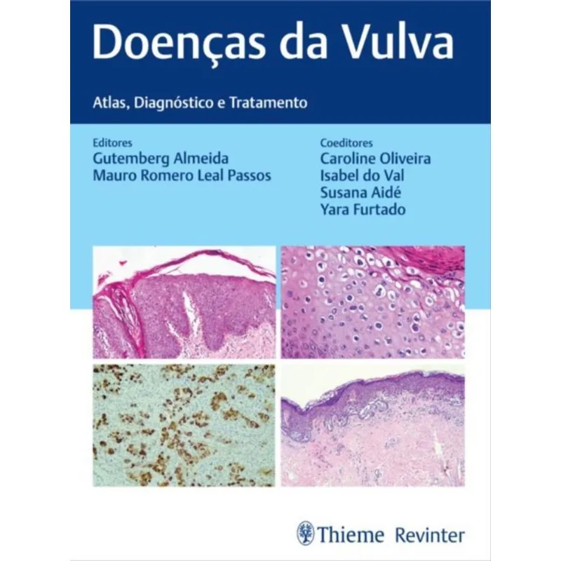 DOENÇAS DA VULVA