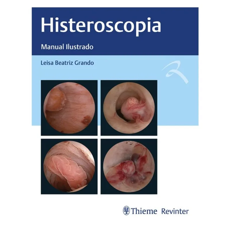 HISTEROSCOPIA