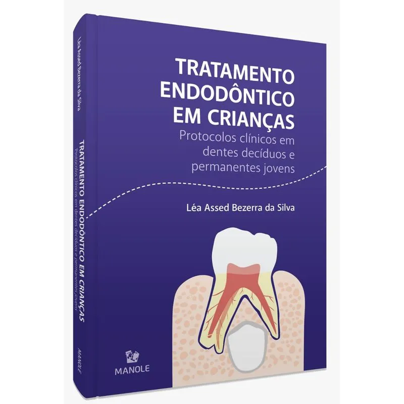 Tratamento Endodôntico Em Crianças - 1ª Edição Protocolos Clínicos Em Dentes Decíduos E Permanentes Jovens