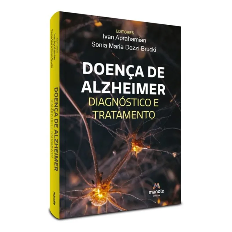DOENÇA DE ALZHEIMER