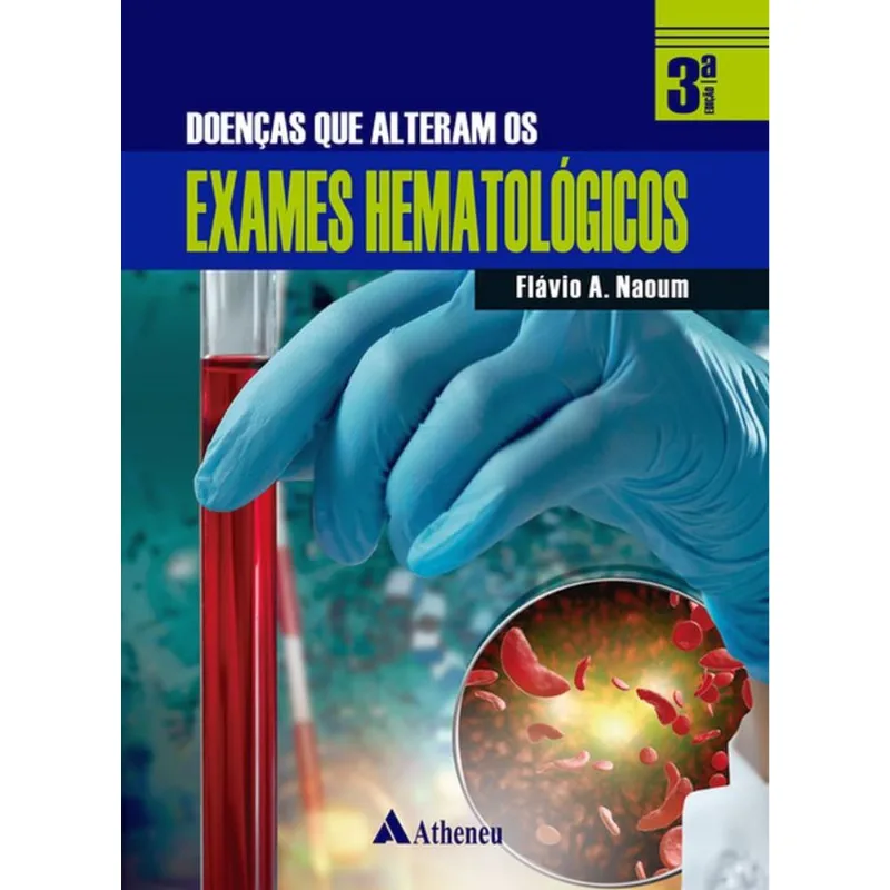 DOENÇAS QUE ALTERAM OS EXAMES HEMATOLÓGICOS
