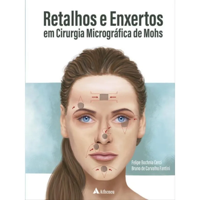 RETALHOS E ENXERTOS EM CIRURGIA MICROGRÁFICA DE MOHS