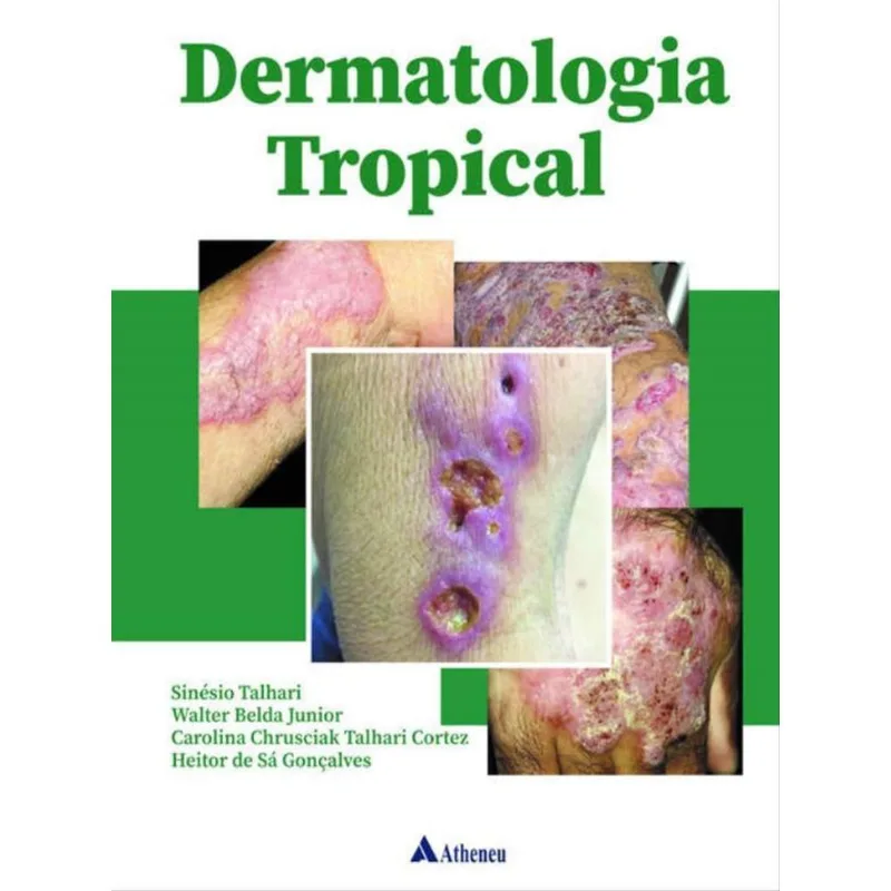 DERMATOLOGIA TROPICAL
