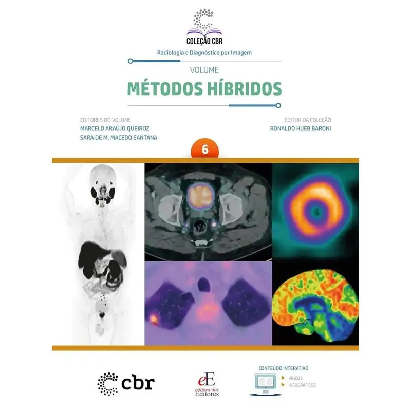 Coleção Cbr Volume 6 Métodos Híbridos