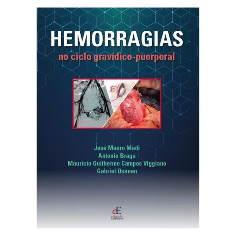 HEMORRAGIAS DO CICLO GRAVÍDICO PUERPERAL