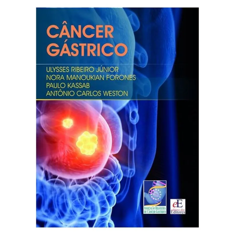 CÂNCER GÁSTRICO