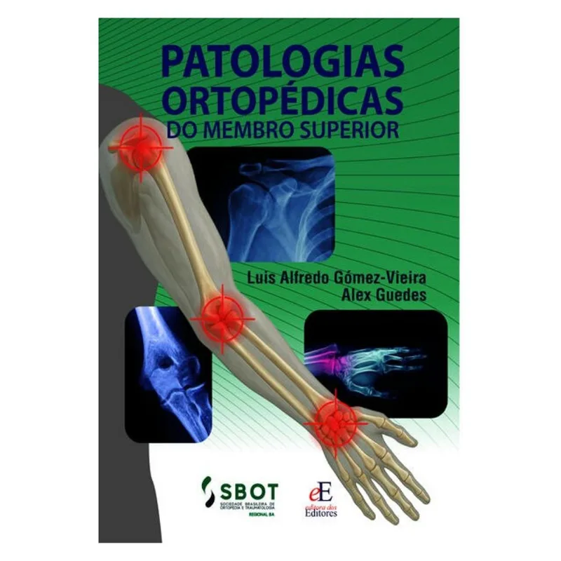 PATOLOGIAS ORTOPÉDICAS DO MEMBRO SUPERIOR