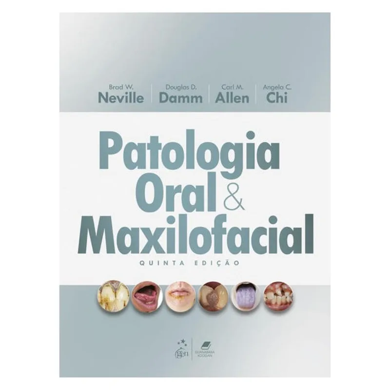 PATOLOGIA ORAL E MAXILOFACIAL