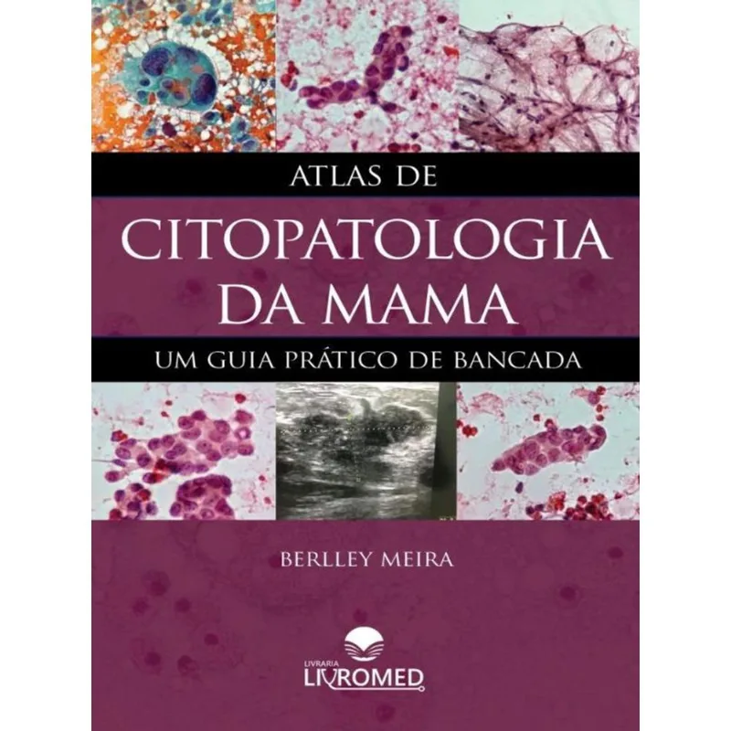 ATLAS DE CITOPATOLOGIA DA MAMA