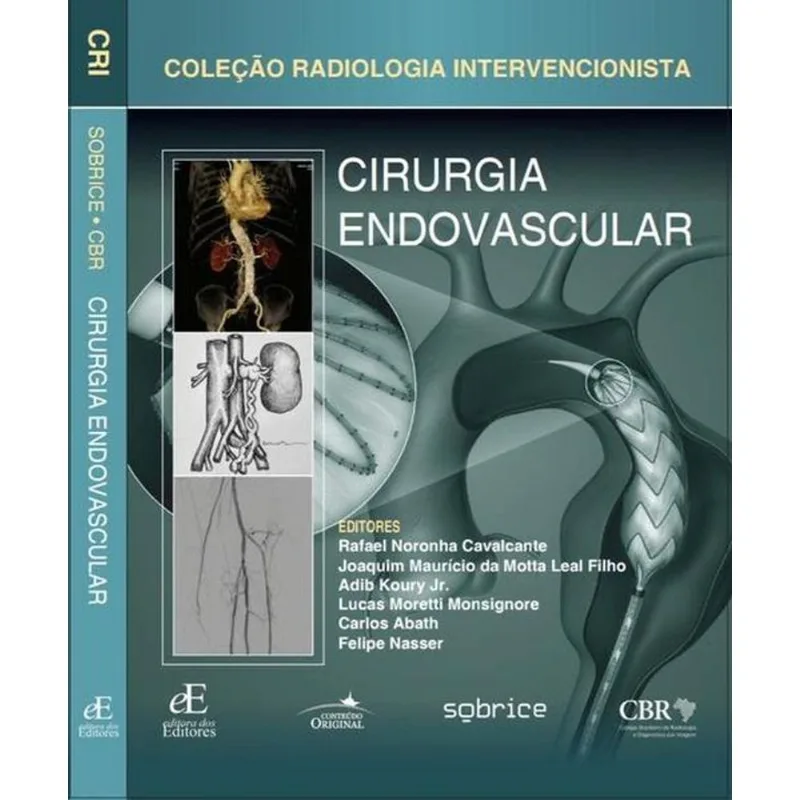 CIRURGIA ENDOVASCULAR