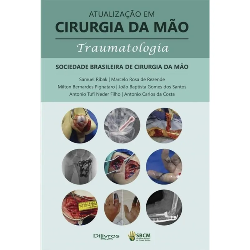 ATUALIZAÇÃO EM CIRURGIA DA MÃO TRAUMATOLOGIA