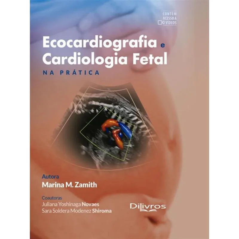 ECOCARDIOGRAFIA E CARDIOLOGIA FETAL E PRATICA