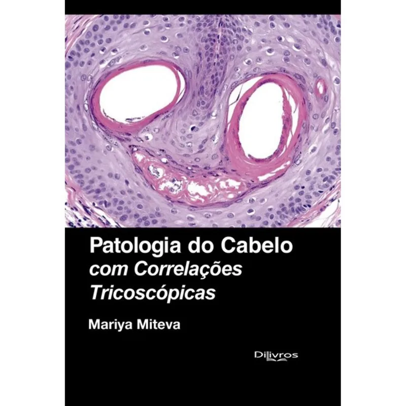 PATOLOGIA DO CABELO COM CORRELACOES TRICOSCOPICAS