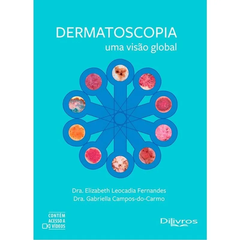 DERMATOSCOPIA UMA VISÃO GLOBAL