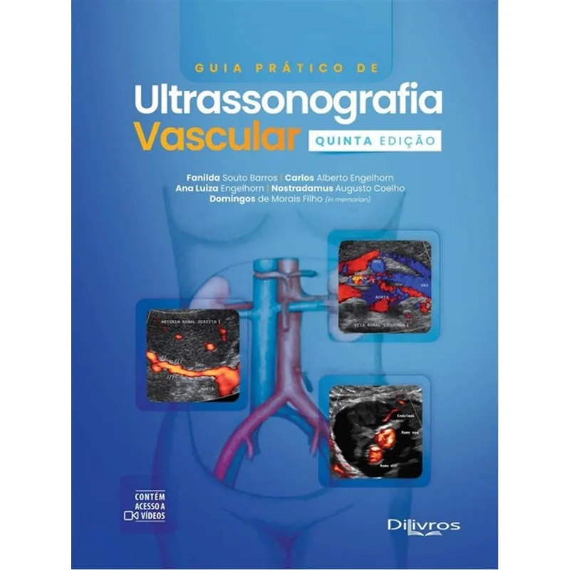 GUIA PRÁTICO DE ULTRASSONOGRAFIA VASCULAR