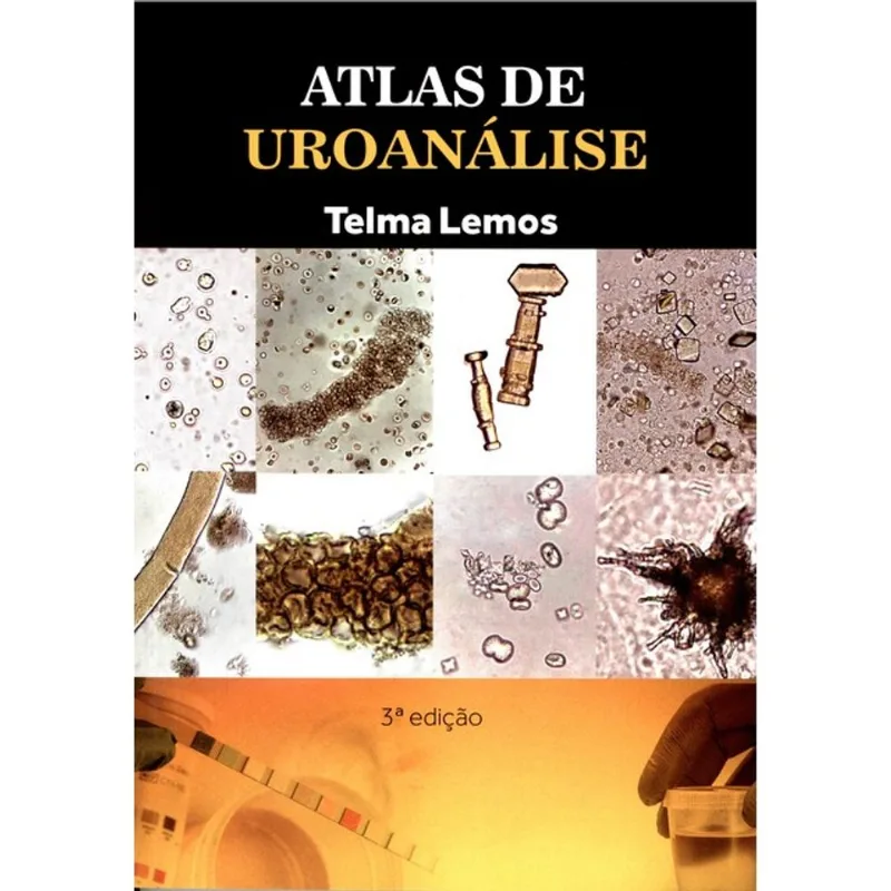 ATLAS DE UROANÁLISE