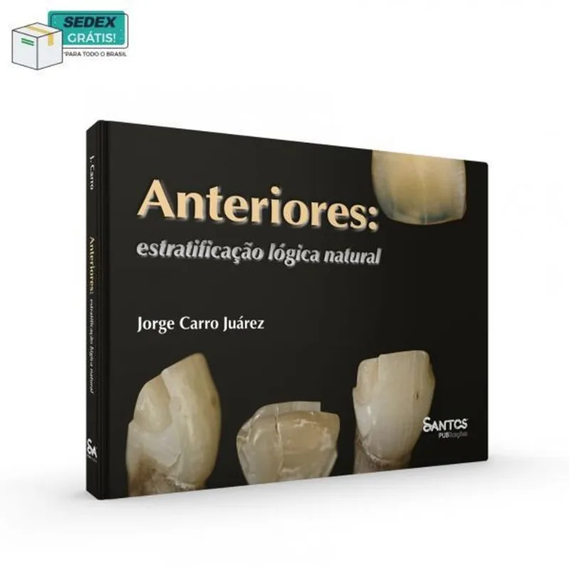 ANTERIORES