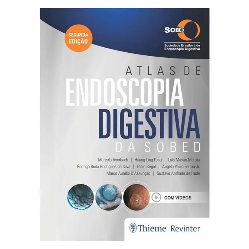 ATLAS DE ENDOSCOPIA DIGESTIVA DA SOBED