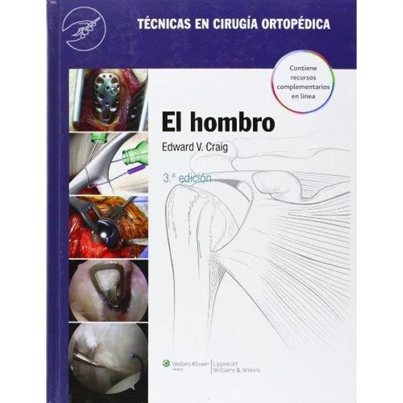 Tecnicas en Cirugia Ortopedica. Hombro/