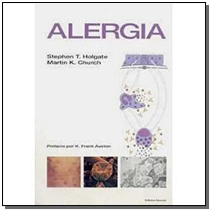 ALERGIA