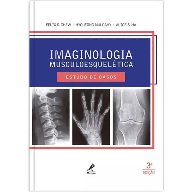 Imaginologia Musculoesquelética