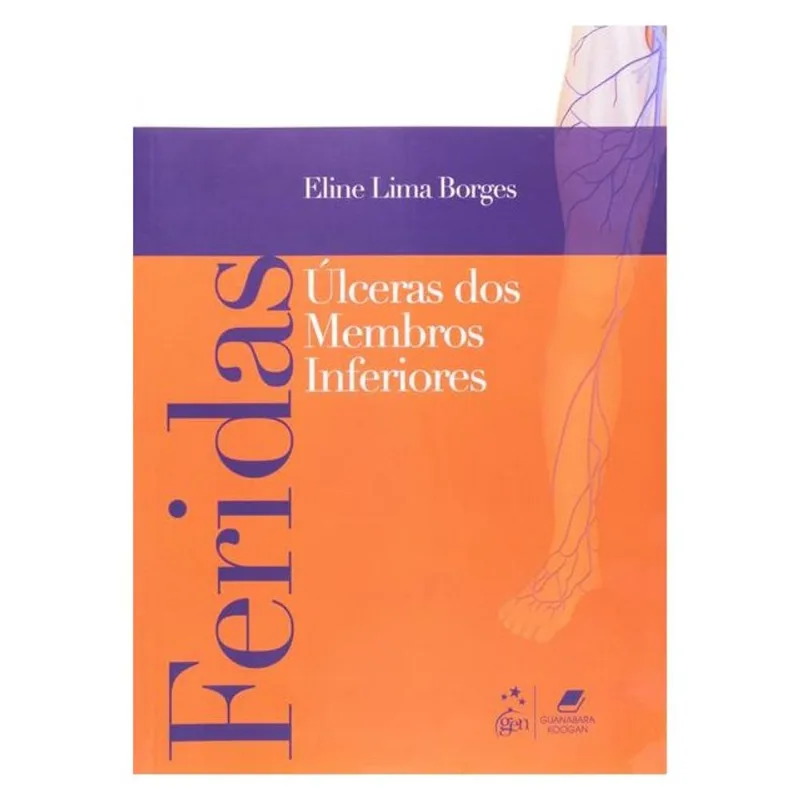 FERIDAS - ÚLCERAS DE MEMBROS INFERIORES