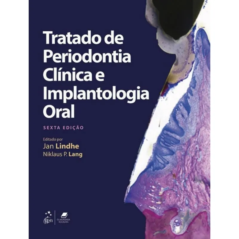 Tratado De Periodontia Clinica E Implantologia Oral - 6A Ed