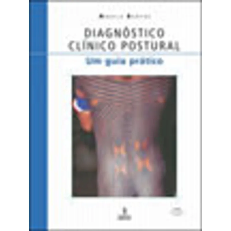 DIAGNÓSTICO CLÍNICO POSTURAL