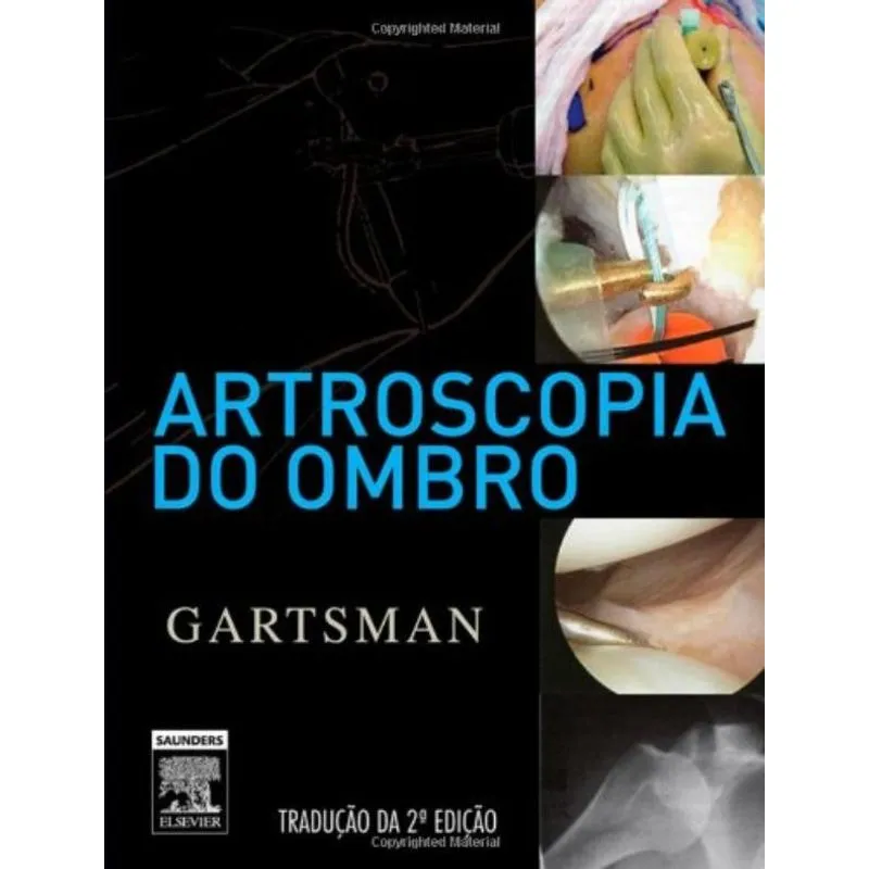 ARTROSCOPIA DO OMBRO