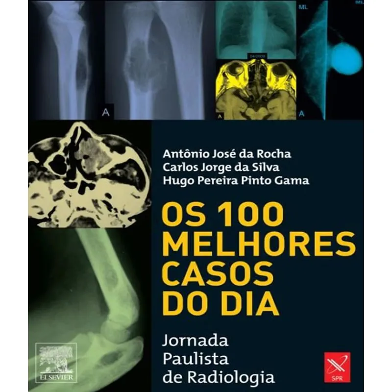 100 Melhores Casos Do Dia, Os