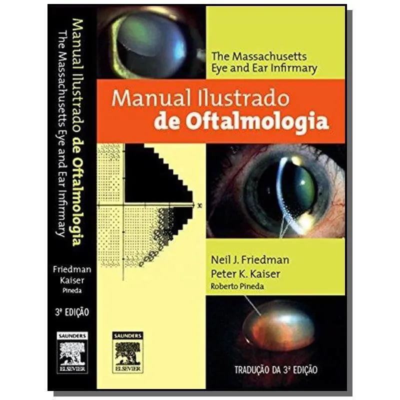 Manual Ilustrado De Oftalmologia