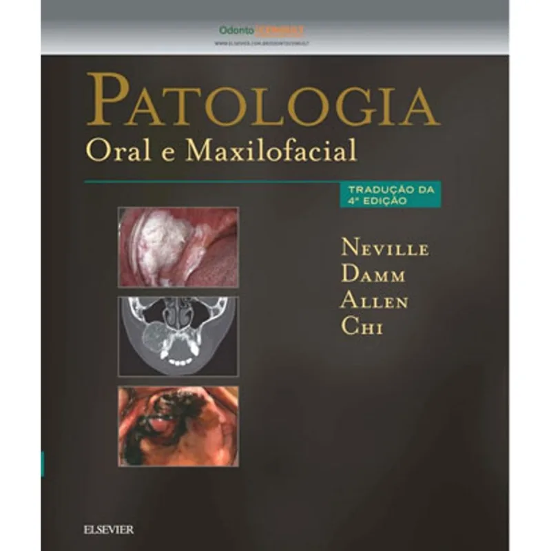 PATOLOGIA ORAL E MAXILOFACIAL