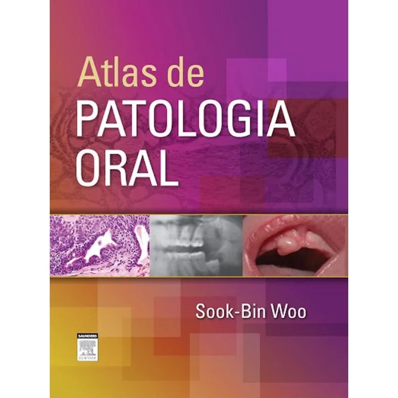 Atlas De Patologia Oral - 1º Ed Livro - Atlas de patologia oral