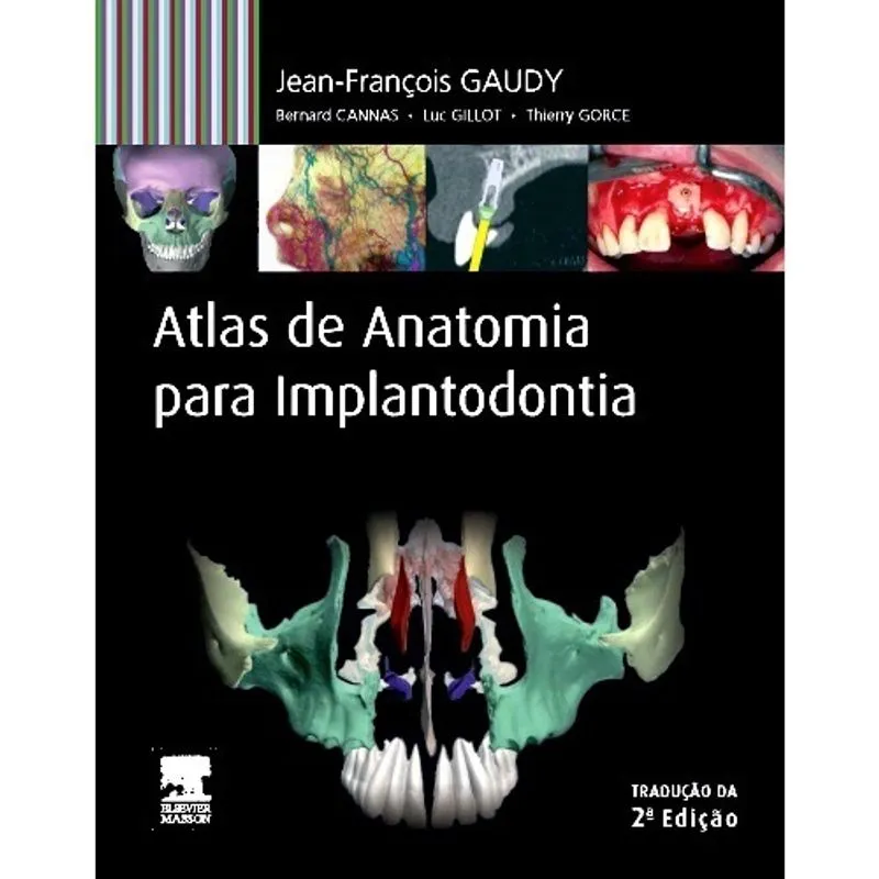 Atlas De Anatomia Para Implantodontia 2Ed 2ª Ed Livro - Atlas de anatomia para implantodontia