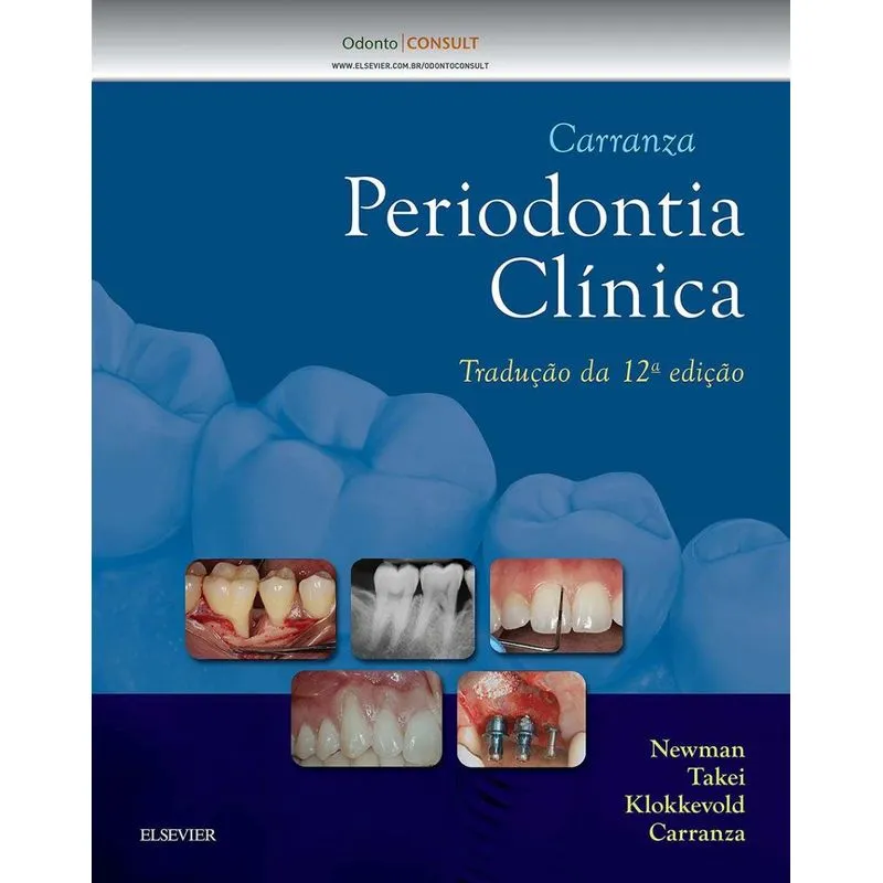 Carranza Periodontia Clínica