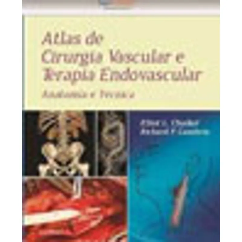 ATLAS DE CIRURGIA VASCULAR E TERAPIA ENDOVASCULAR